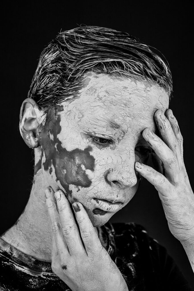 VIOの色素沈着を治す市販薬はどれが効果的？